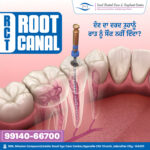 "Best root canal treatment in Jalandhar by Dr. Isha Sood"