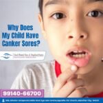 canker sores in children inside mouth