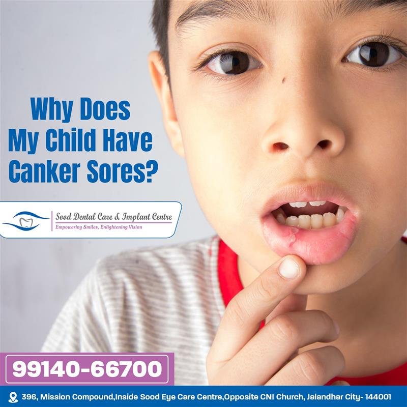 canker sores in children inside mouth